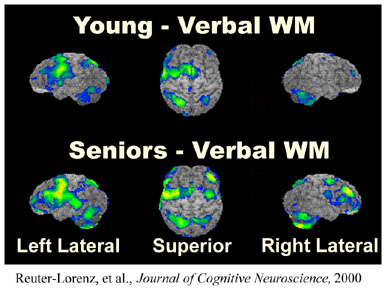 comparisons of PET images of youngand aged brains