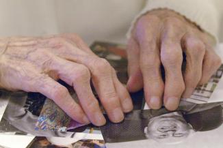 Les mains d'une femme atteinte de la maladie d'Alzheimer, principale cause de dpendance des personnes ges en France. | AFP/MEHDI FEDOUACH