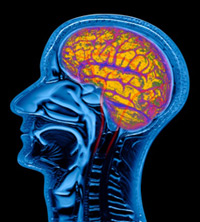 An MRI scan of man's brain