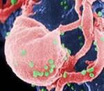 HIV on the Surface of White Blood Cells - Image by Centers for Disease Control; Cdc.gov