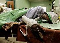 A Sri Lankan man identified as H.G. 
Sirisena -- whom local newspapers said 
had survived 14 days buried beneath the 
rubble of a building that collapsed in 
the December 26 tsunami -- lies on a 
hospital bed January 9, 2005 after 
surgery in Karapatiya. Local residents 
cast doubt on his story, however, saying 
he was a mentally-ill man who had been 
spotted only days ago in the area. 
REUTERS/Yves 
Herman