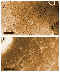 Liver blood vessell walls