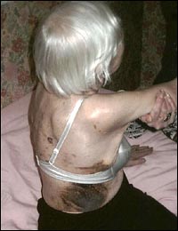 Horrendous ... injuries